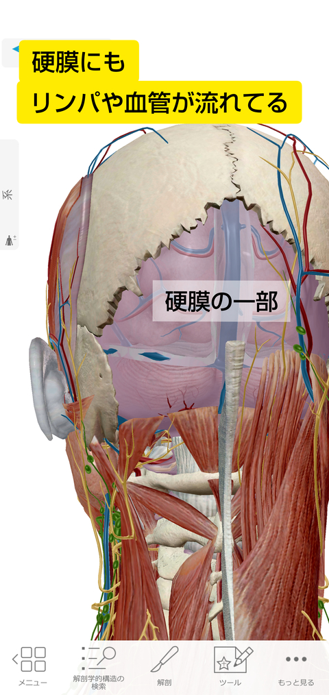 後頭骨からの硬膜 (1)